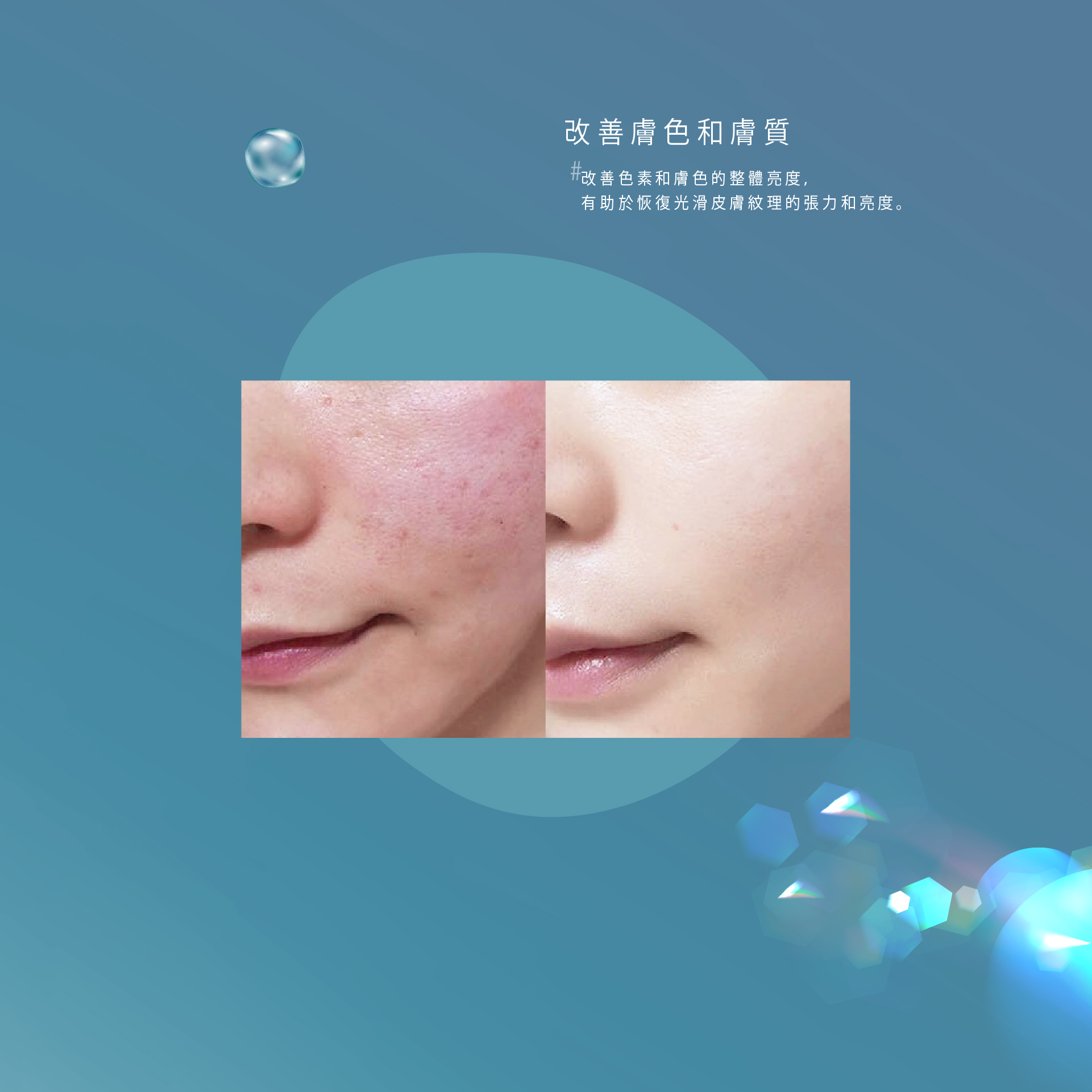 Rejuran Healer麗珠蘭 Before and After 效果